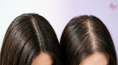 Queda de cabelo sazonal: por que cai mais no outono